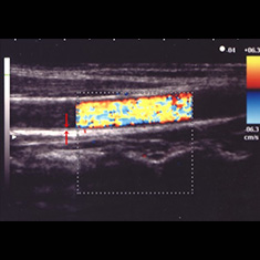 超音波診断 画像