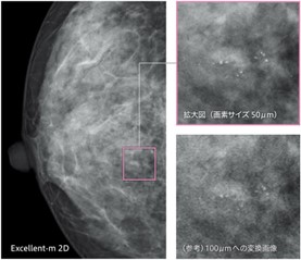 左右の乳房を2方向で撮影します。