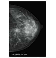 左右の乳房を2方向で撮影します。