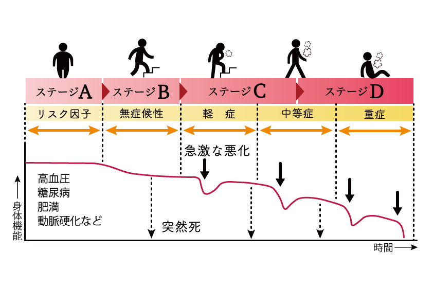 心不全は悪化と回復を繰り返しながら進行する