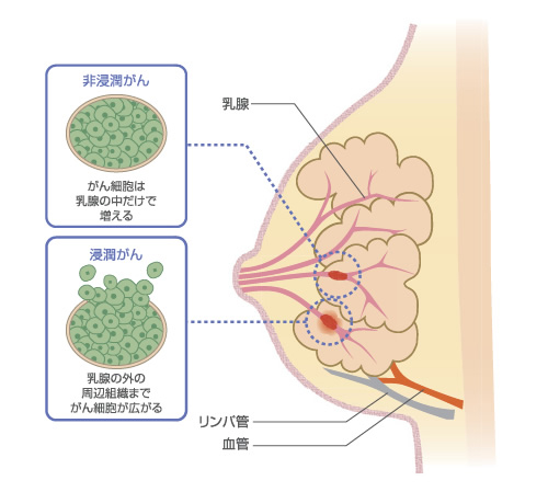 手術（外科治療）