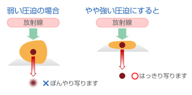 手術(外科治療)
