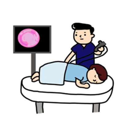 図 大腸内視鏡検査