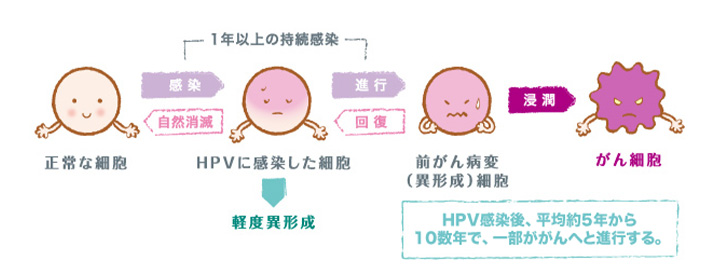 子宮頸がん細胞の発生メカニズム