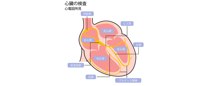 心電図 低 電位