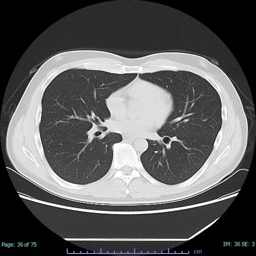 Mriとctの違い 画像診断検査 各検査を知る 人間ドック 健診会 東京メディカルクリニック