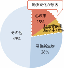 日本人の主要な死亡要因