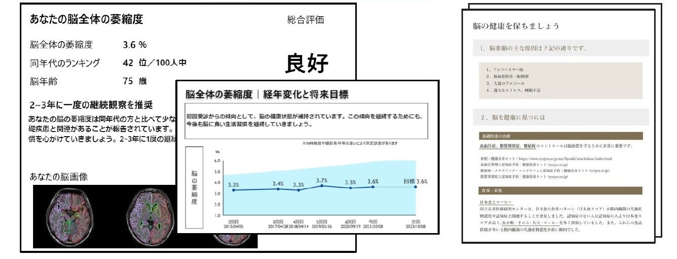 脳の健康維持は生活習慣から