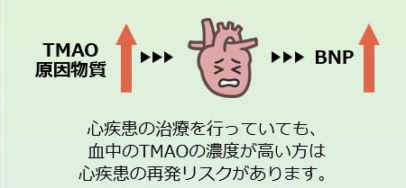 他の心疾患の検査との違い