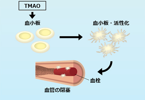 TMAOはなぜ心疾患や脳梗塞のリスクを高めるの？